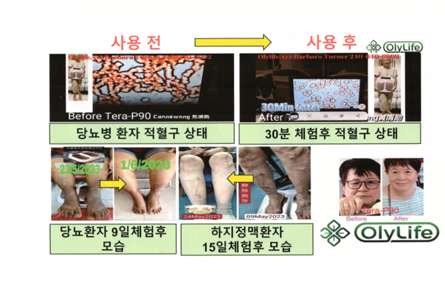 올리라이프, 발마사지기로 치매·암 치료?