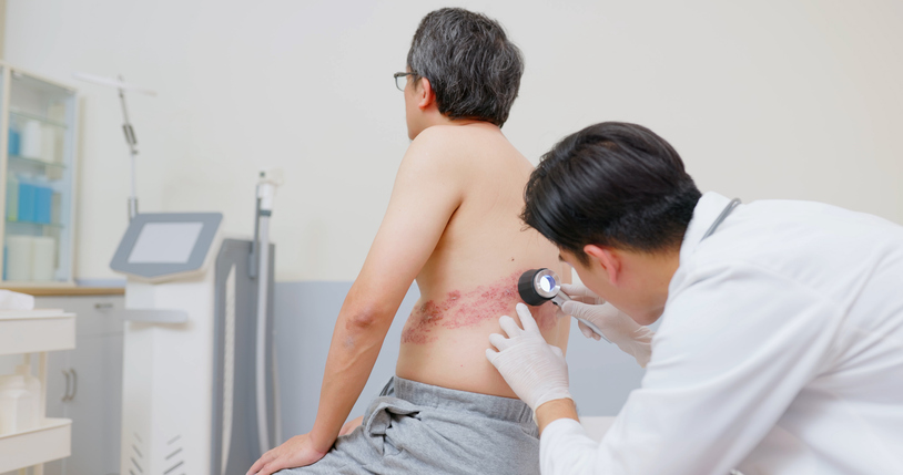 건강한 노후 생활 위협하는 ‘대상포진’