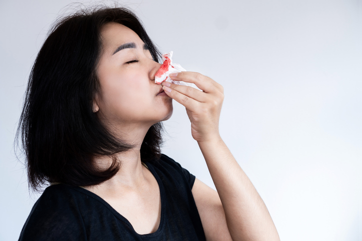 코피 날 때  고개 젖히지 마세요!