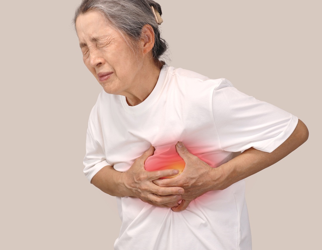 심근경색, 조기 예방과 관리가 생명을 지킨다